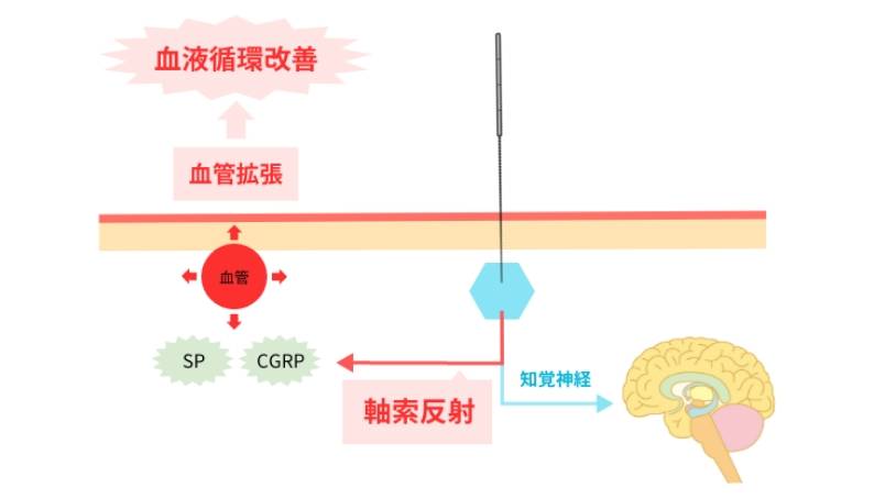 鍼治療の仕組み